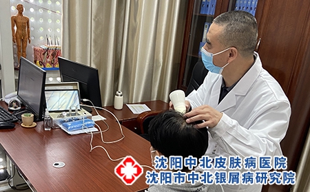 沈陽專治牛皮癬的醫(yī)院:紅皮型牛皮癬都有哪些危害存在?