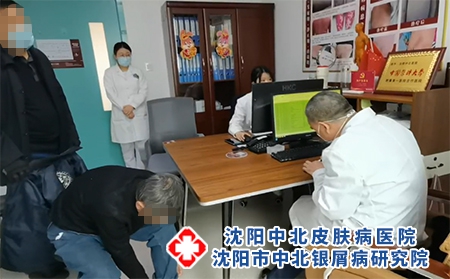 沈陽醫(yī)院銀屑病好-沈陽主治銀屑病醫(yī)院