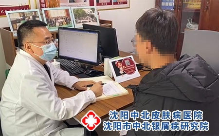 沈陽(yáng)市中北銀屑病-沈陽(yáng)銀屑病去哪兒治