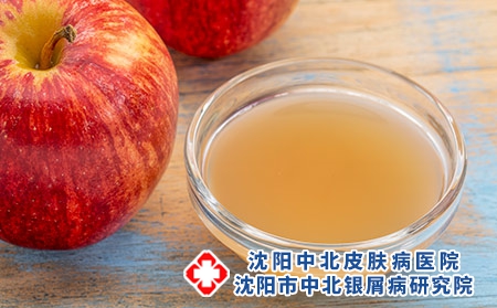 攝圖網_304211345_與母親一起生蘋果醋一個小玻璃碗有新鮮的紅蘋果（企業(yè)商用）