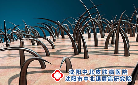 攝圖網(wǎng)_401926276_頭發(fā)生長（企業(yè)商用）