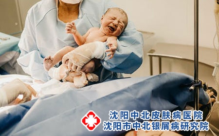 嬰兒