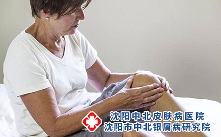 2 (179)關(guān)節(jié)