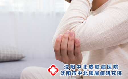 攝圖網(wǎng)_500708291_生病的年輕人胳膊疼（企業(yè)商用）關節(jié)