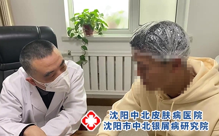 沈陽(yáng)銀屑病名中醫(yī)-沈陽(yáng)中北銀屑病醫(yī)院-沈陽(yáng)牛皮癬防治醫(yī)院