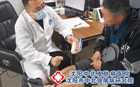沈陽(yáng)哪有治銀屑病-沈陽(yáng)中北銀屑病研究院-沈陽(yáng)銀屑病哪治最好 沈陽(yáng)哪有治銀屑病-沈陽(yáng)中北銀屑病研究院-沈陽(yáng)銀屑病哪治最好