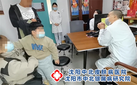 沈陽哪的銀屑病好-沈陽市中北銀屑病研究院-沈陽哪里有治銀屑病