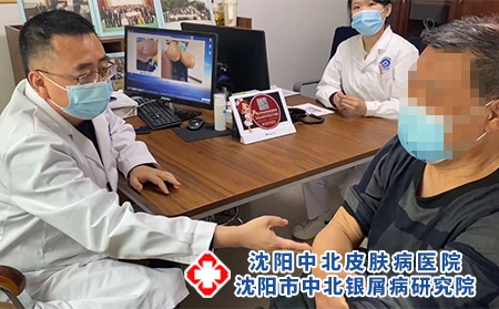 沈陽銀屑病哪家好-沈陽中北銀屑病醫(yī)院-沈陽牛皮癬治療哪好