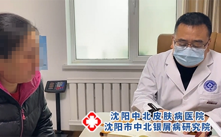 沈陽看銀屑病哪好-沈陽市中北銀屑病研究院-沈陽哪有治療銀屑病