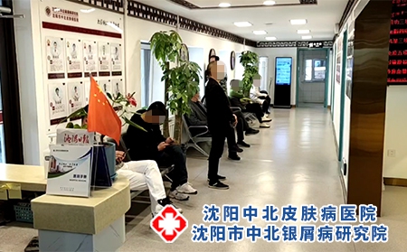 沈陽銀屑病哪里治-沈陽中北銀屑病醫(yī)院-沈陽治牛皮癬哪兒好