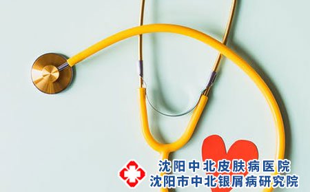 沈陽中北銀屑病醫(yī)院解析頭上皮癬怎么治